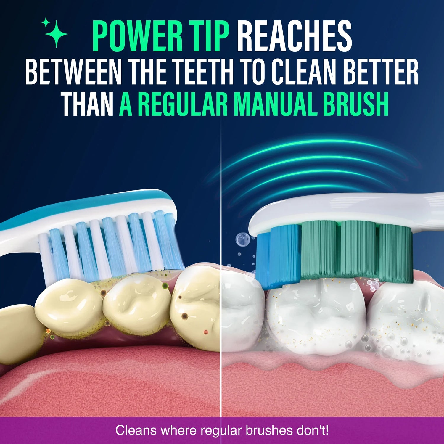 Advanced Replacement Brush Heads for Pressure Sensor Sonic Toothbrush - 6 Count