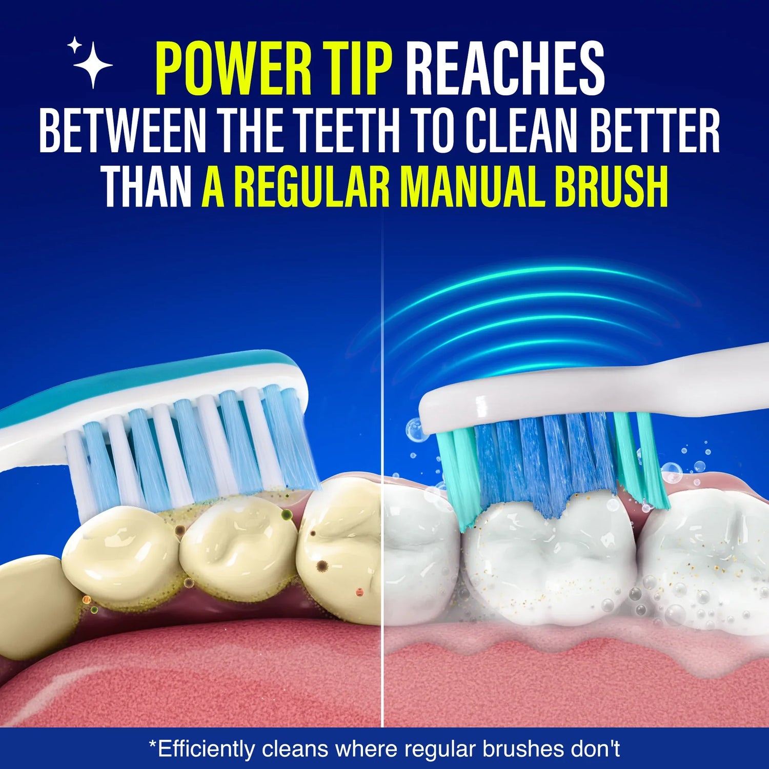 Essential Replacement Brush Heads for Pressure Sensor Sonic Toothbrush - 6 Count