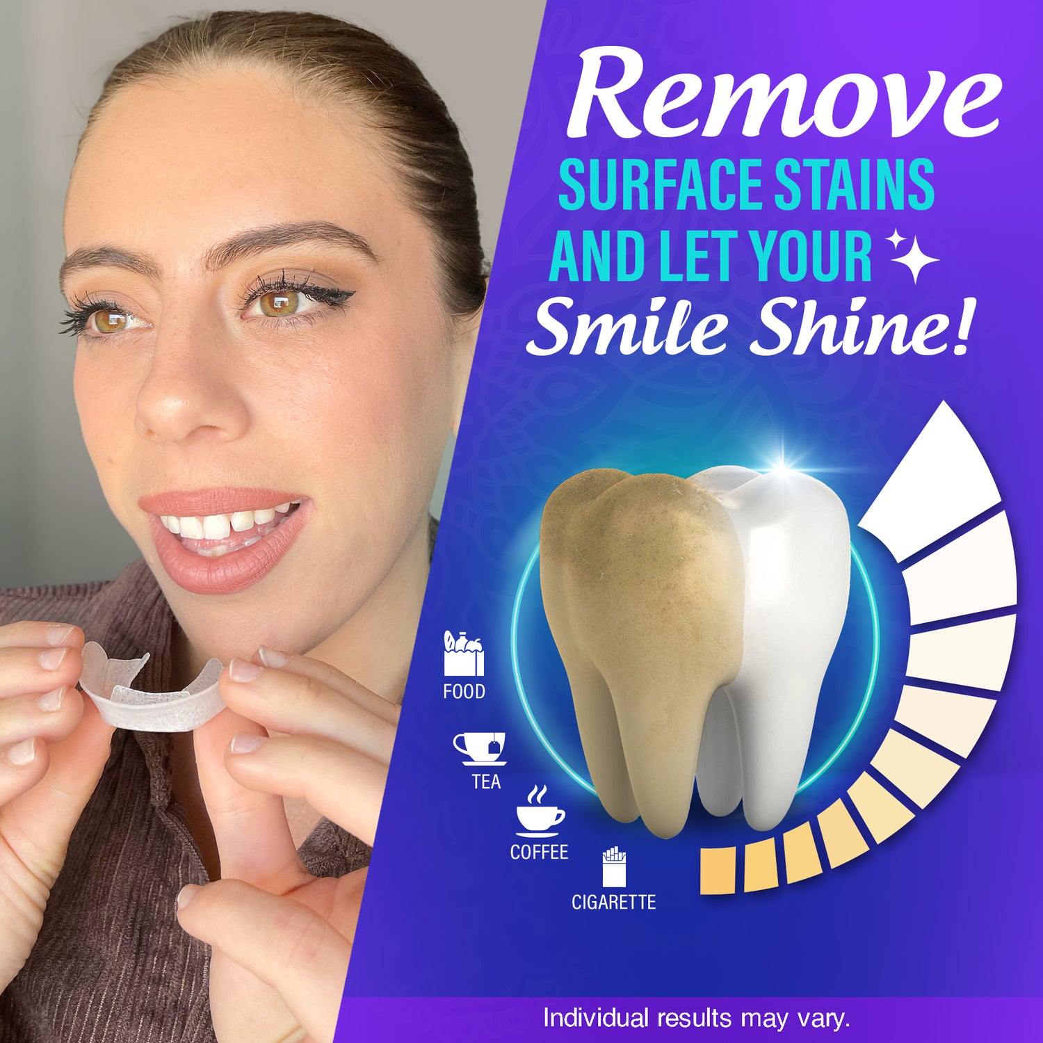 Professional Ready-to-Use Whitening Trays (7 Treatments)