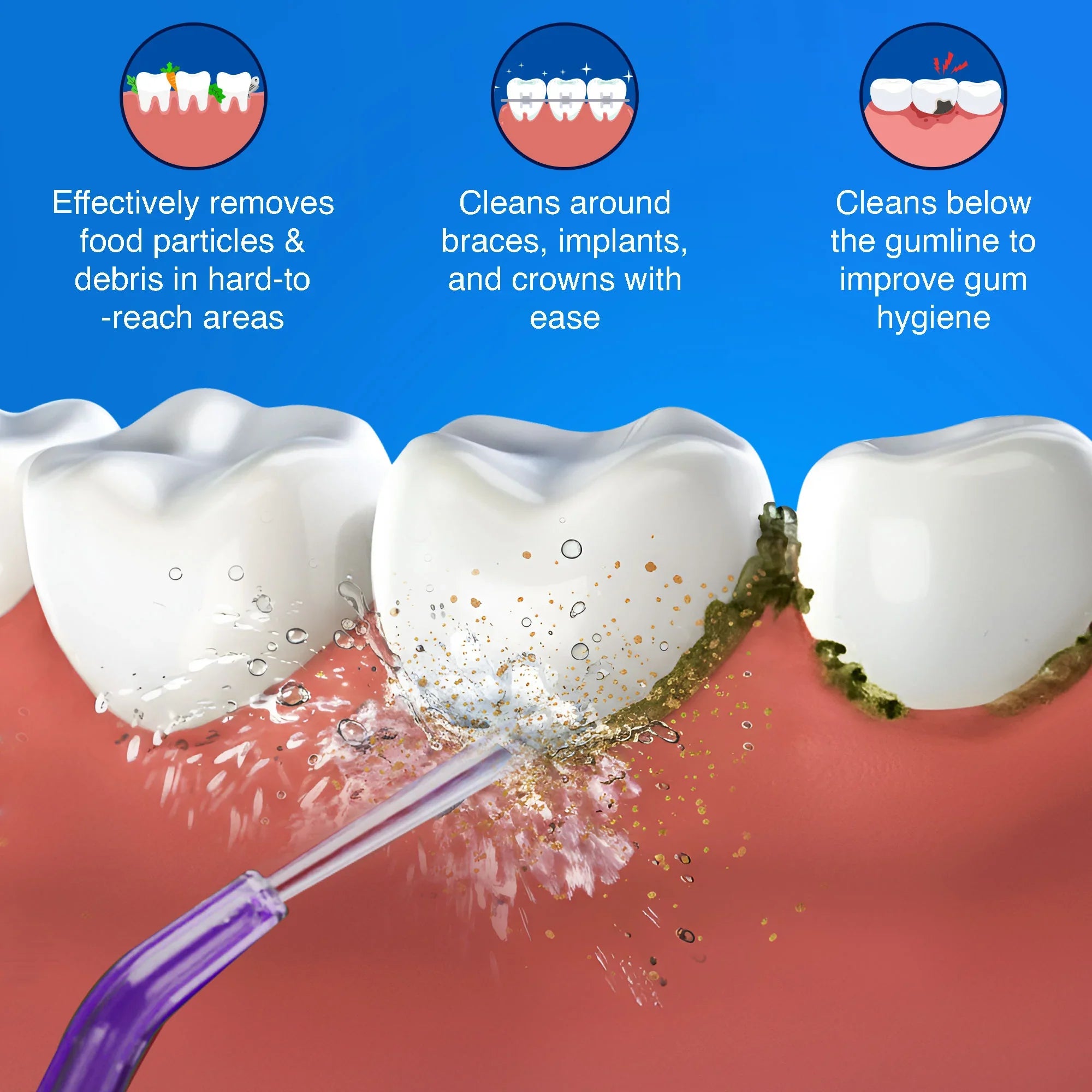 Replacement Floss Tips for Deep Clean Dental Water Flosser 2.0 XL