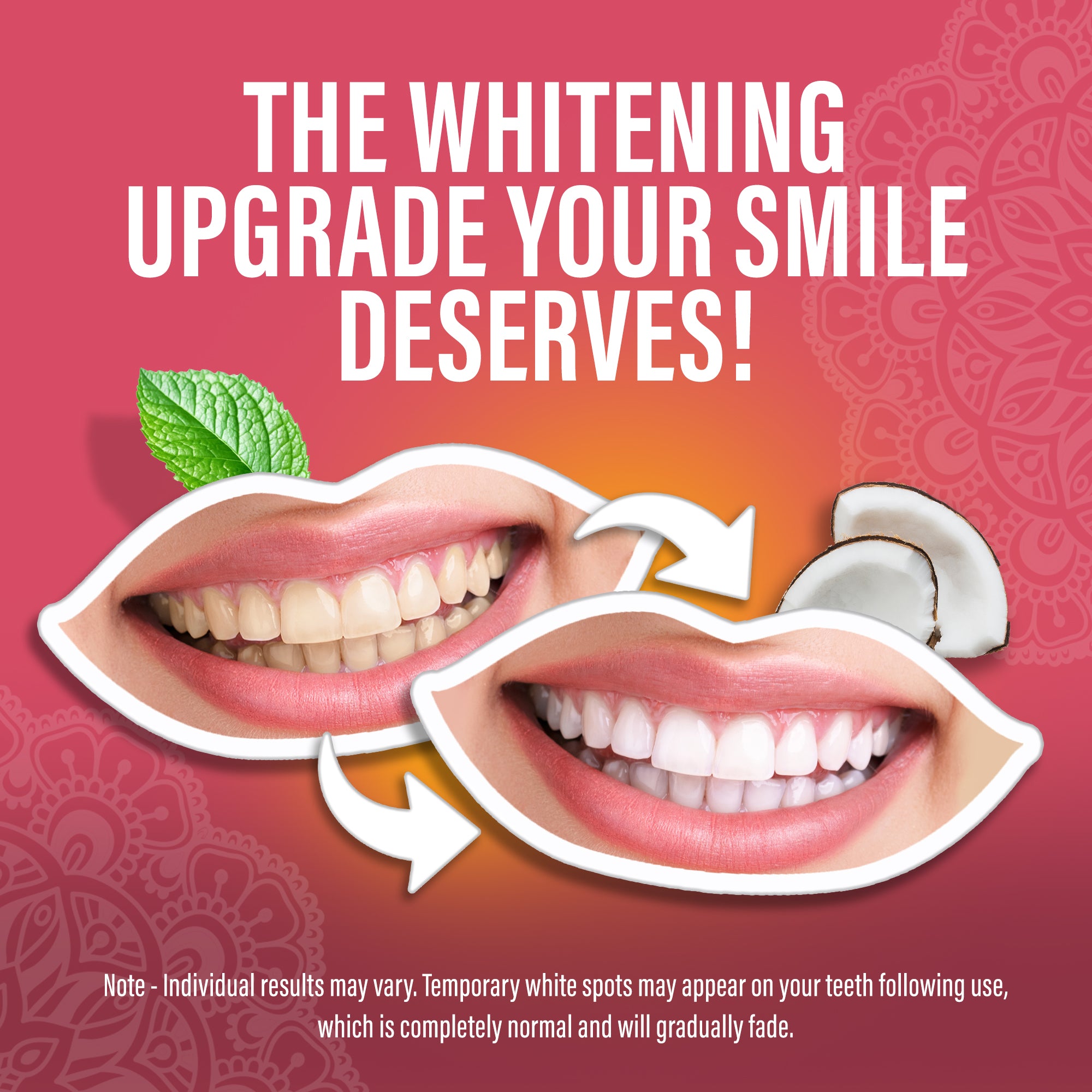 Sensitive Whitening Strips – 16 Treatments