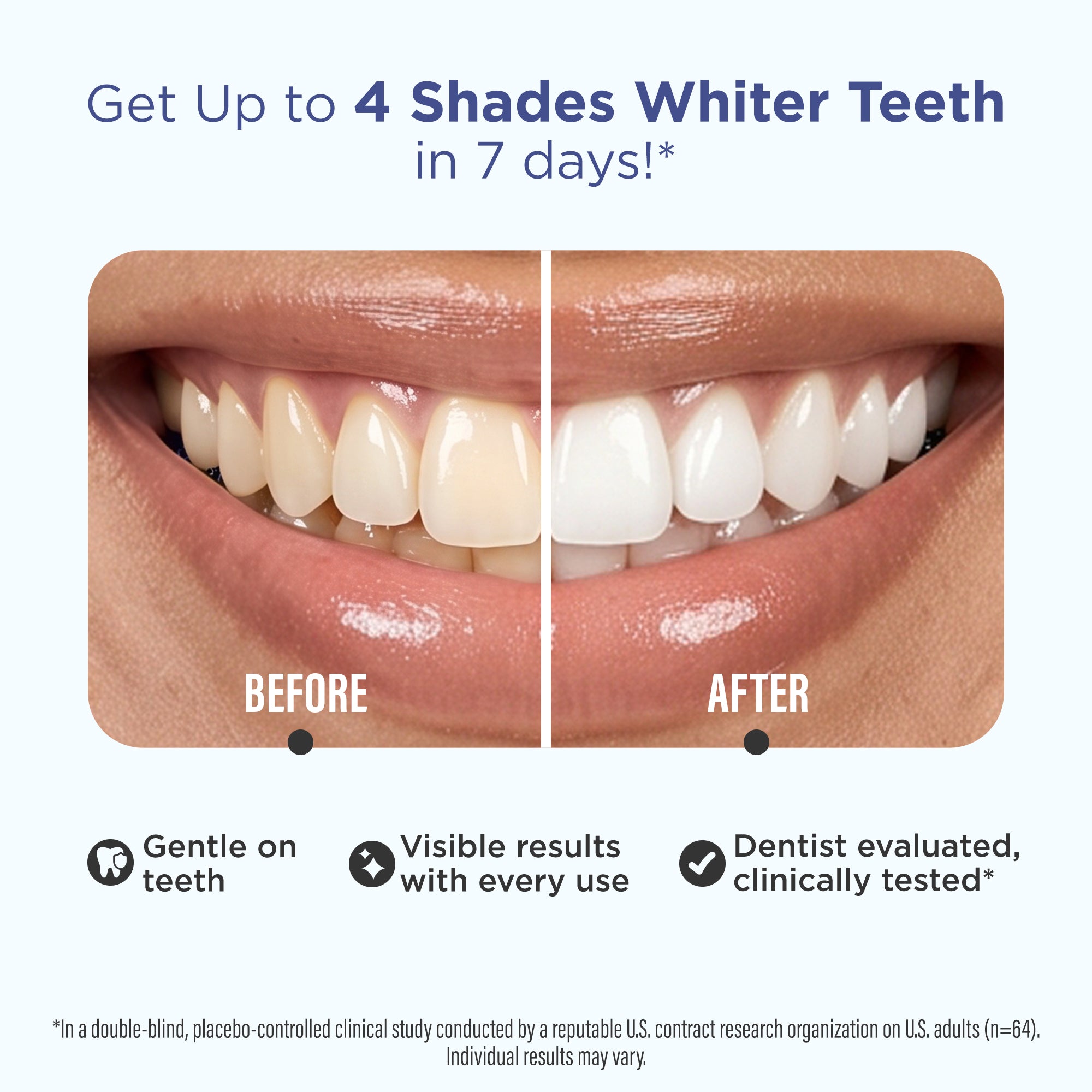 GuruNanda Whitening Strips before and after comparison showing teeth up to 4 shades whiter in 7 days, clinically tested and gentle on teeth