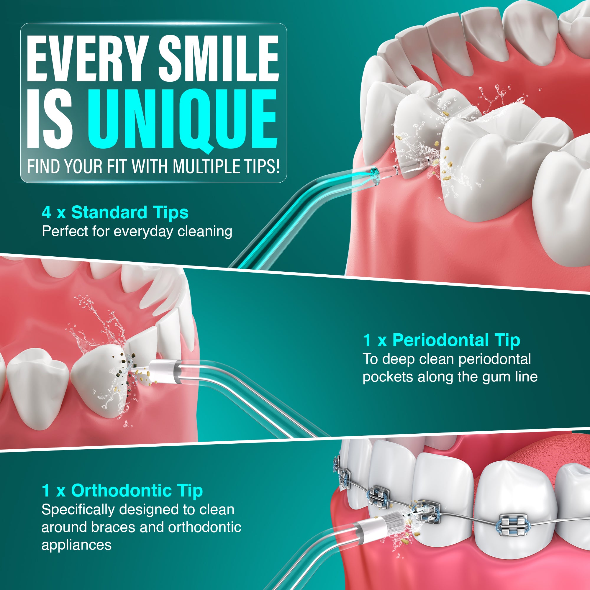 Replacement Water Flosser Tips for Model R3100/R3100A - 6 Pack