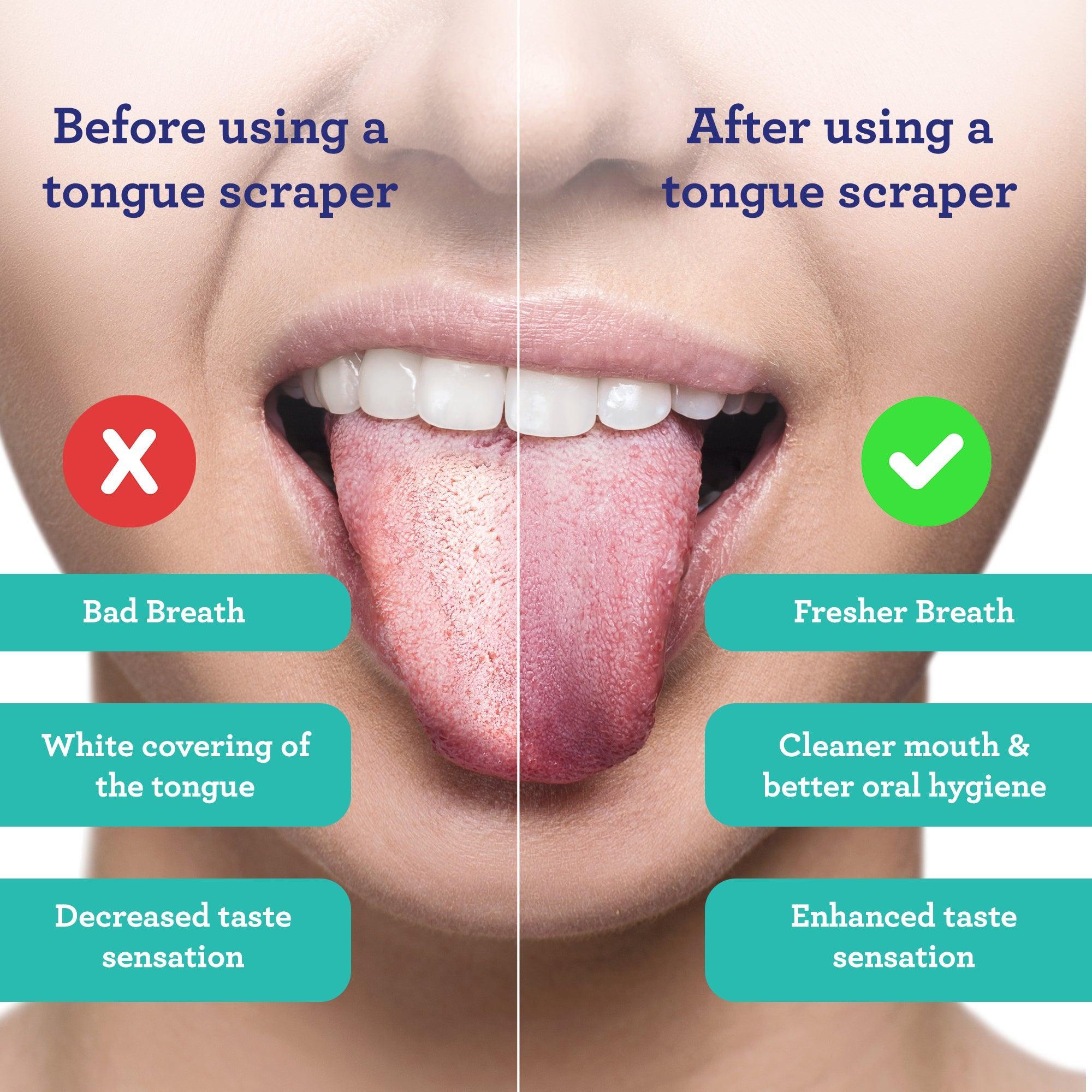 U Shaped Stainless Steel Tongue Scraper (2-Pack) - GuruNanda