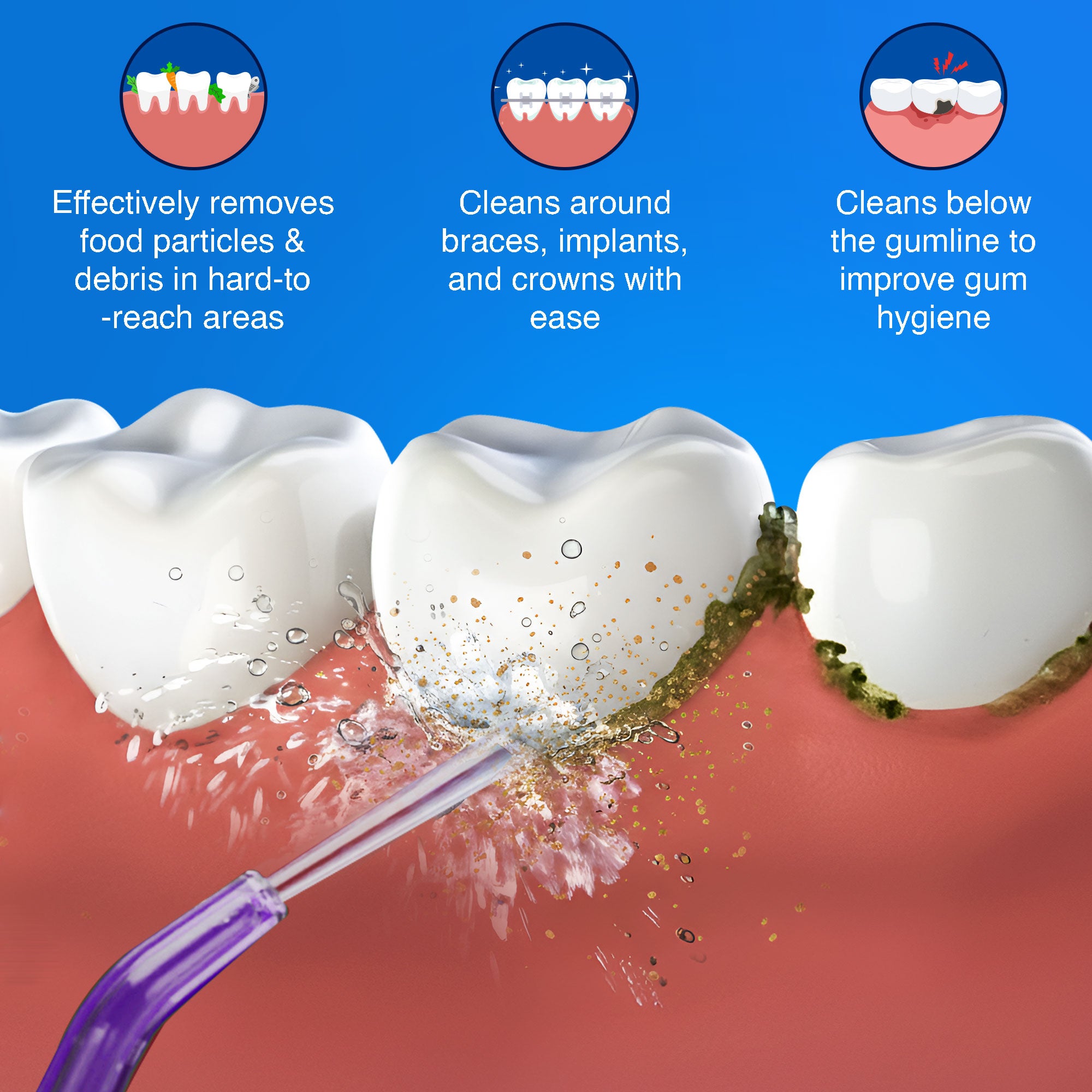 Replacement Floss Tips for Deep Clean Dental Water Flosser 2.0 XL