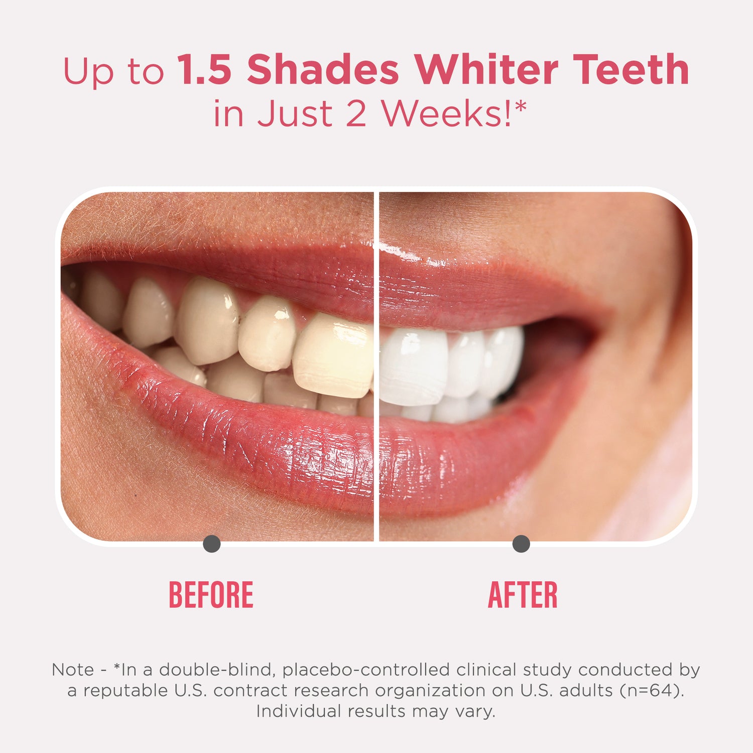 Sensitive Whitening Strips – 9 Day Treatment