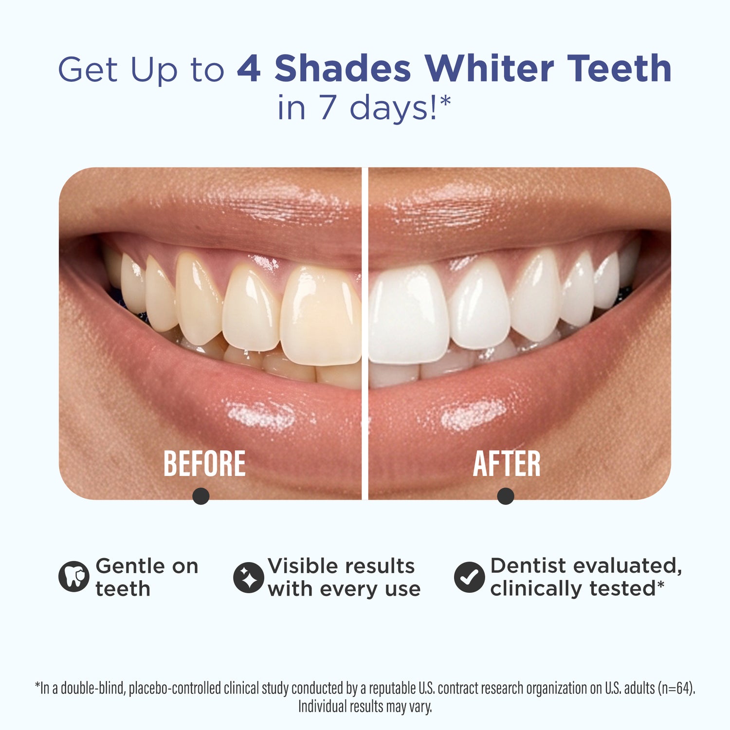 GuruNanda Whitening Strips before and after comparison showing teeth up to 4 shades whiter in 7 days, clinically tested and gentle on teeth