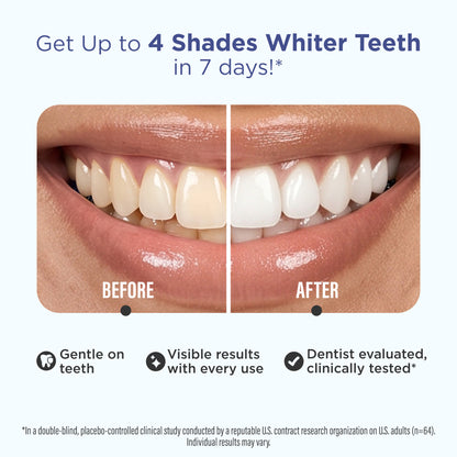GuruNanda Whitening Strips before and after comparison showing teeth up to 4 shades whiter in 7 days, clinically tested and gentle on teeth