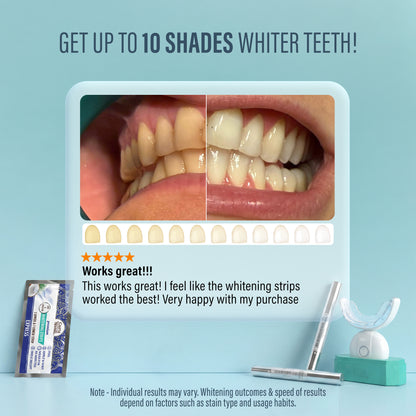 Kit de blanqueamiento dental LED inalámbrico