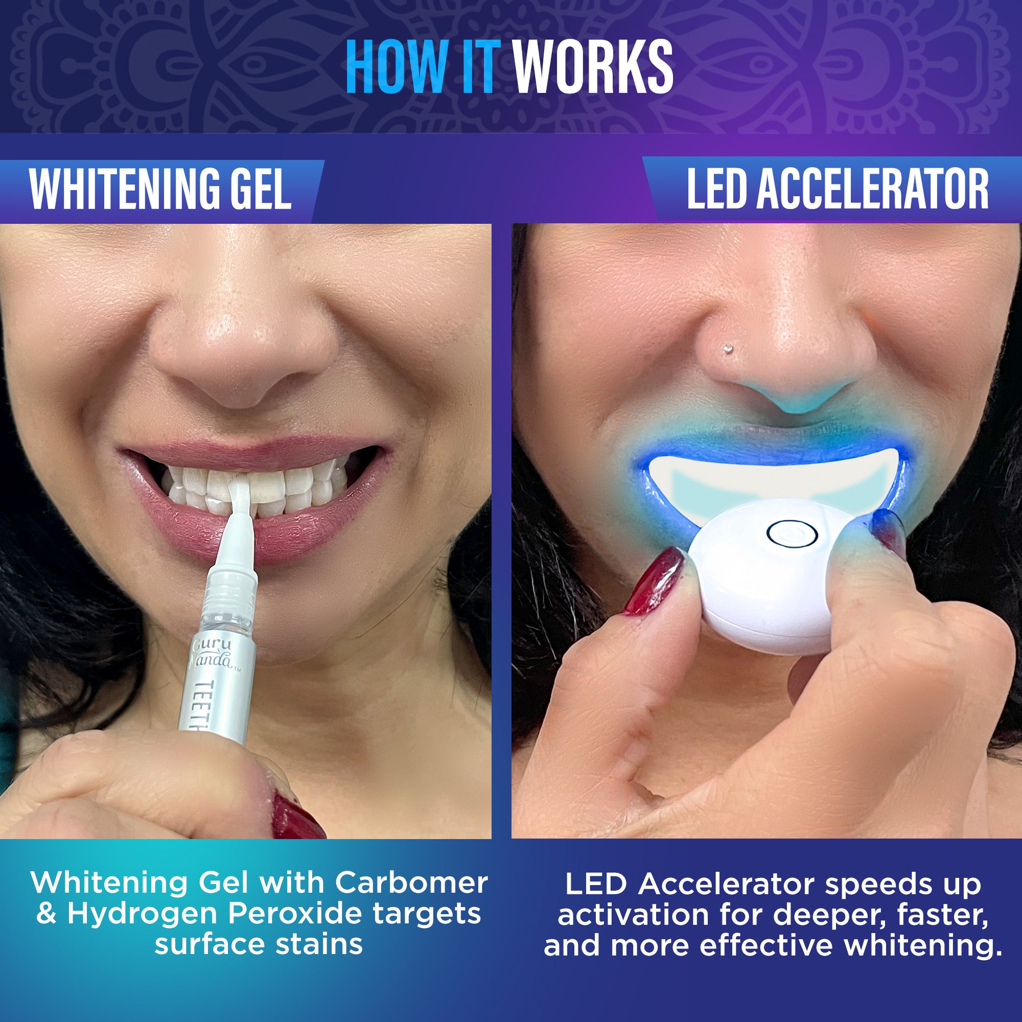 Professional Whitening Wireless Kit