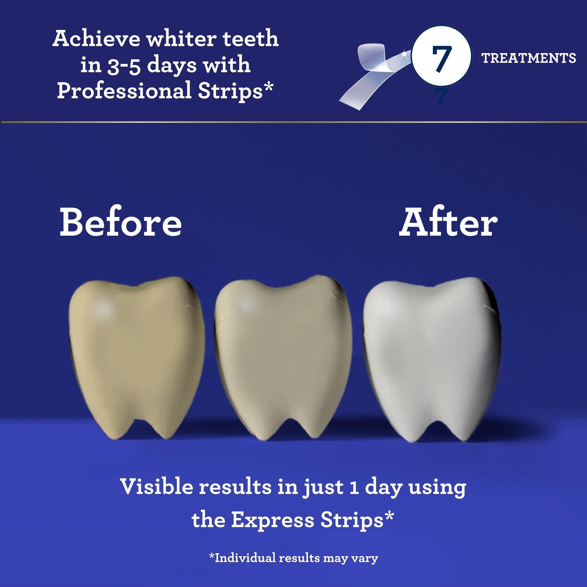 Gurunanda Teeth Whitening Strips Enamel Safe 7 Day Treatment 