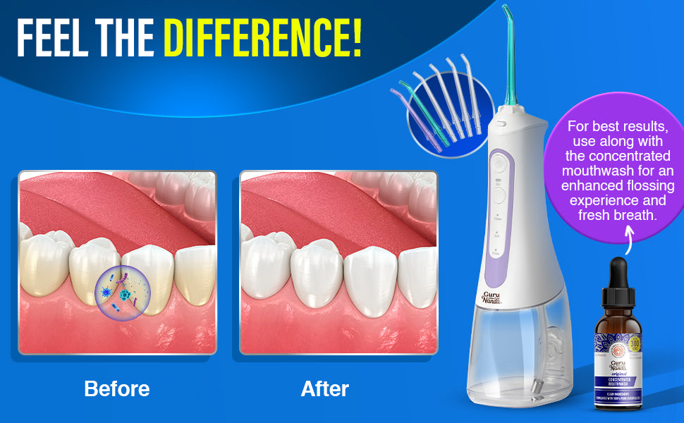 Before and after