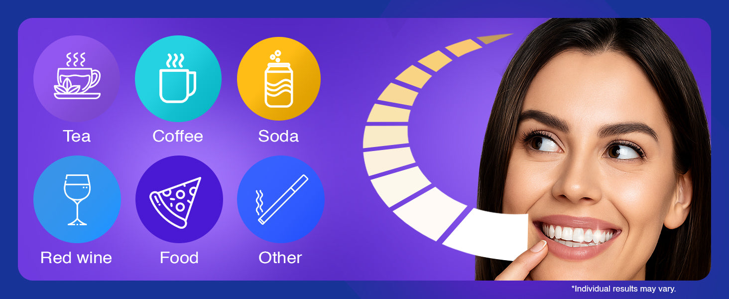 GuruNanda Professional Ready-to-Use Whitening Trays 7 Treatments